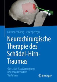 bokomslag Neurochirurgische Therapie des Schdel-Hirn-Traumas