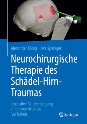 bokomslag Neurochirurgische Therapie des Schädel-Hirn-Traumas