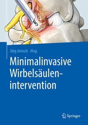 bokomslag Minimalinvasive Wirbelsulenintervention