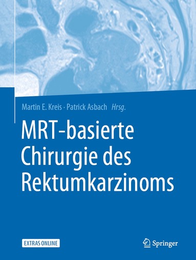 Martin E. Kreis, Patrick Asbach - MRT-basierte Chirurgie des Rektumkarzinoms, Inbunden