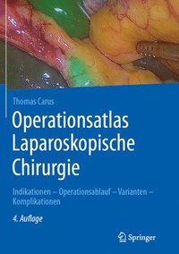 bokomslag Operationsatlas Laparoskopische Chirurgie