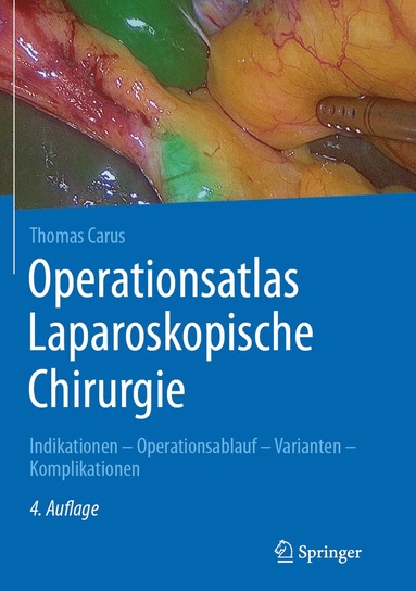 bokomslag Operationsatlas Laparoskopische Chirurgie