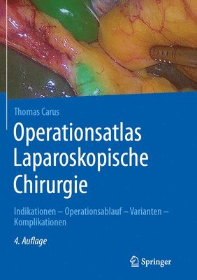 Operationsatlas Laparoskopische Chirurgie 1