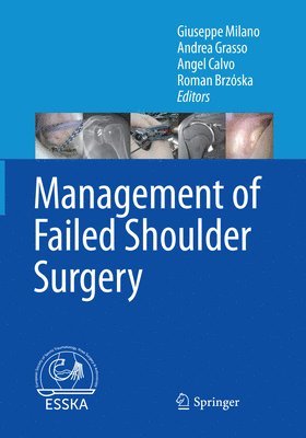 Management of Failed Shoulder Surgery 1