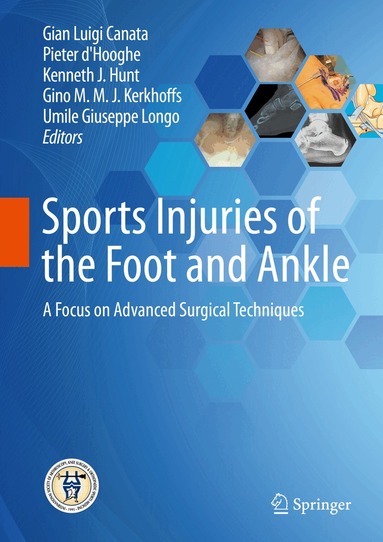 Gian Luigi Canata, Pieter d'Hooghe, Kenneth J. Hunt, Gino M.M.J. Kerkhoffs, Umile Giuseppe Longo - Sports Injuries of the Foot and Ankle, Inbunden