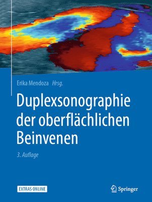 Erika Mendoza - Duplexsonographie der oberflächlichen Beinvenen, Inbunden