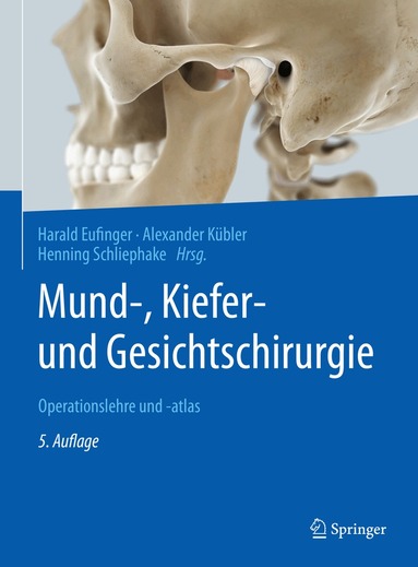 Harald Eufinger, Alexander Kübler, Henning Schliephake - Mund-, Kiefer- und Gesichtschirurgie, Inbunden