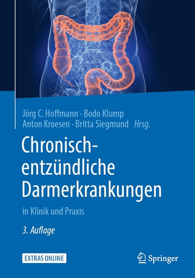Jörg C. Hoffmann, Bodo Klump, Anton Kroesen, Britta Siegmund - Chronisch-entzündliche Darmerkrankungen, Inbunden