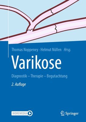 Varikose 1