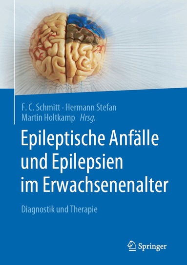F.C. Schmitt, Hermann Stefan, Martin Holtkamp - Epileptische Anfälle und Epilepsien im Erwachsenenalter, Inbunden