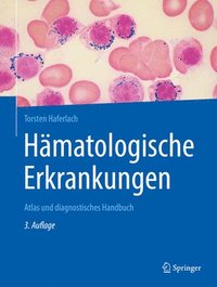 bokomslag Hmatologische Erkrankungen