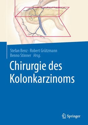 bokomslag Chirurgie des Kolonkarzinoms