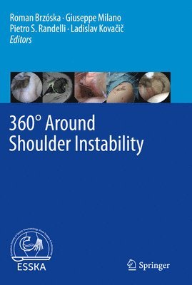 bokomslag 360° Around Shoulder Instability