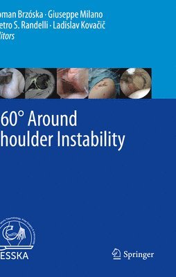 bokomslag 360 Around Shoulder Instability