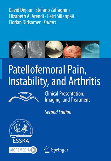 David Dejour, Stefano Zaffagnini, Elizabeth A. Arendt, Petri Sillanpää, Florian Dirisamer - Patellofemoral Pain, Instability, and Arthritis, Inbunden