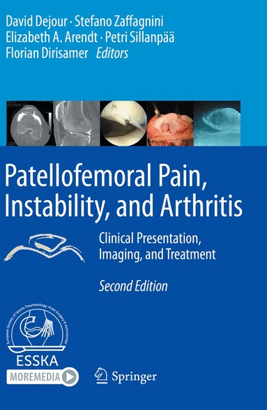 David Dejour, Stefano Zaffagnini, Elizabeth A. Arendt, Petri Sillanpää, Florian Dirisamer - Patellofemoral Pain, Instability, and Arthritis, Häftad