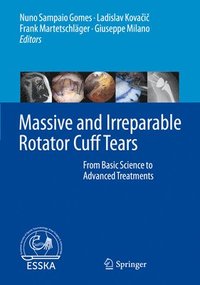 bokomslag Massive and Irreparable Rotator Cuff Tears