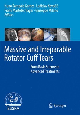 bokomslag Massive and Irreparable Rotator Cuff Tears