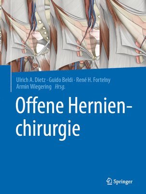 bokomslag Offene Hernienchirurgie