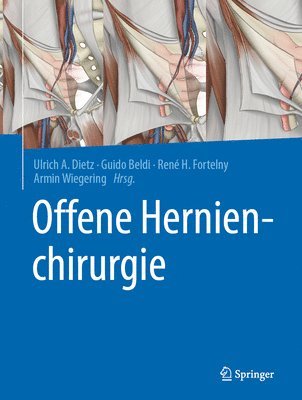 Offene Hernienchirurgie 1