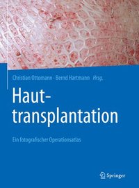 bokomslag Hauttransplantation