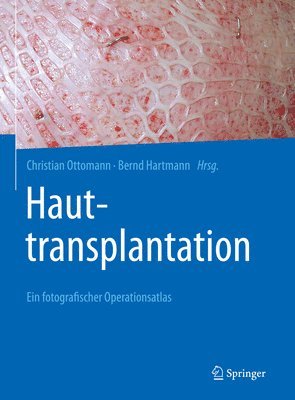 Hauttransplantation 1
