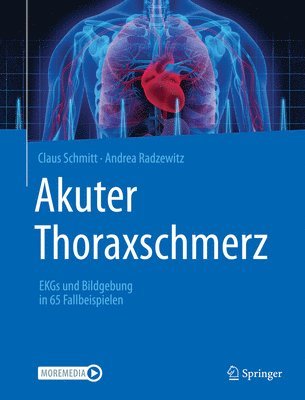 Akuter Thoraxschmerz 1