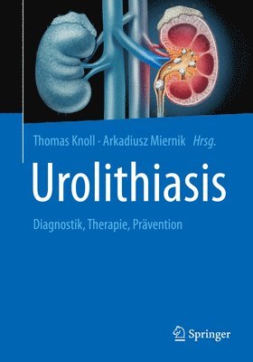 bokomslag Urolithiasis