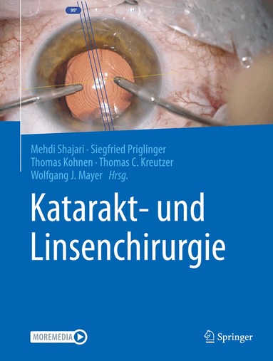 Mehdi Shajari, Siegfried Priglinger, Thomas Kohnen, Thomas C. Kreutzer, Wolfgang J. Mayer - Katarakt- und Linsenchirurgie, Inbunden