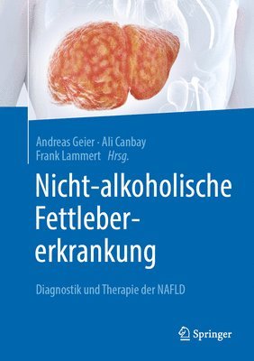 bokomslag Nicht-alkoholische Fettlebererkrankung