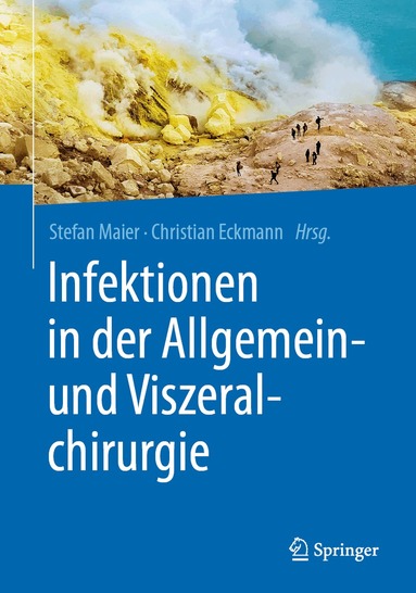 Stefan Maier, Christian Eckmann - Infektionen in der Allgemein- und Viszeralchirurgie, Häftad