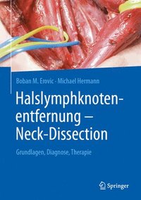 bokomslag Halslymphknotenentfernung  Neck-Dissection