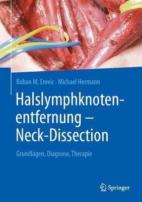 bokomslag Halslymphknotenentfernung - Neck-Dissection