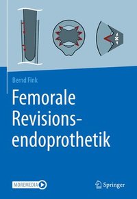 bokomslag Femorale Revisionsendoprothetik