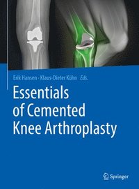 bokomslag Essentials of Cemented Knee Arthroplasty