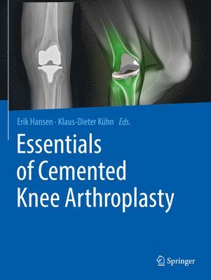 bokomslag Essentials of Cemented Knee Arthroplasty
