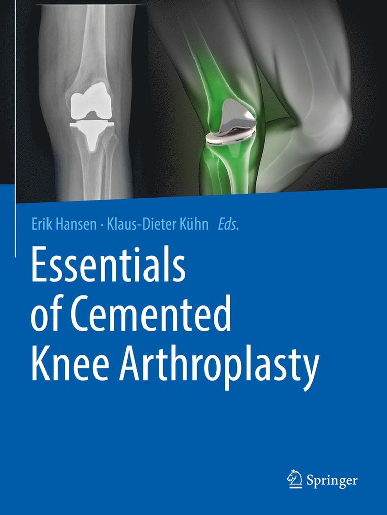 Erik Hansen, Klaus-Dieter Kühn, Klaus-Dieter Kuhn - Essentials of Cemented Knee Arthroplasty, Häftad