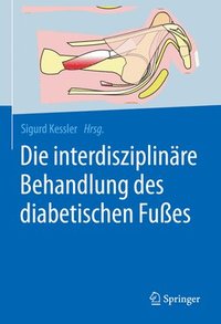 bokomslag Die interdisziplinre Behandlung des diabetischen Fues