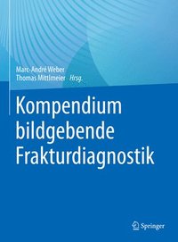 bokomslag Kompendium bildgebende Frakturdiagnostik