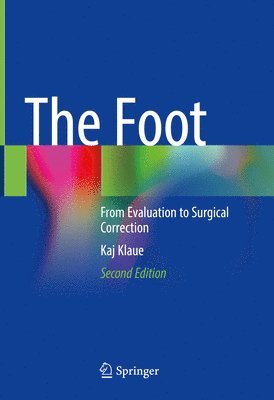 The Foot 1