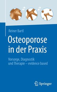 bokomslag Osteoporose in der Praxis