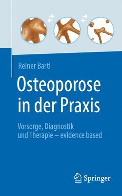 Osteoporose in der Praxis 1