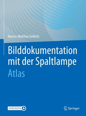 bokomslag Bilddokumentation mit der Spaltlampe