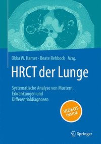 bokomslag HRCT der Lunge