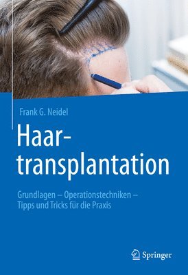 bokomslag Haartransplantation