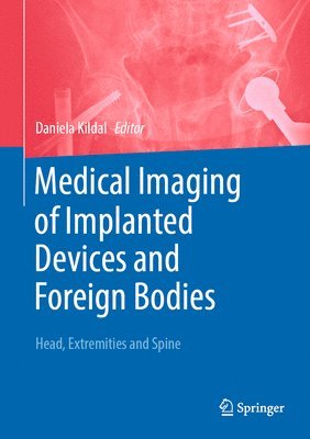 bokomslag Medical Imaging of Implanted Devices and Foreign Bodies