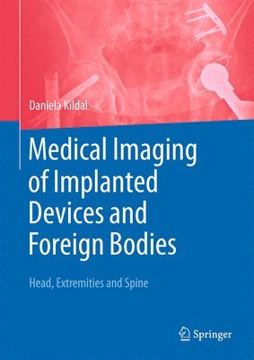 Medical Foreign Bodies in Imaging 1