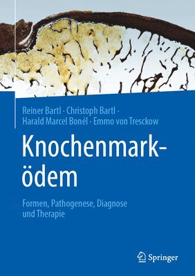 Knochenmarkdem 1