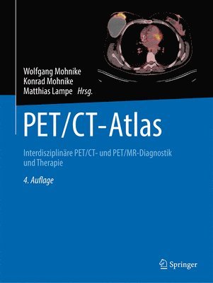 PET/CT-Atlas 1