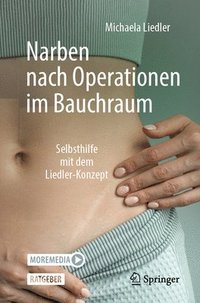 bokomslag Narben nach Operationen im Bauchraum